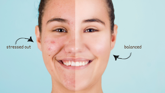 Stress and Skin Doshas: Ayurveda Tips (Skin, Food and Lifestyle) to Bring Balance Back